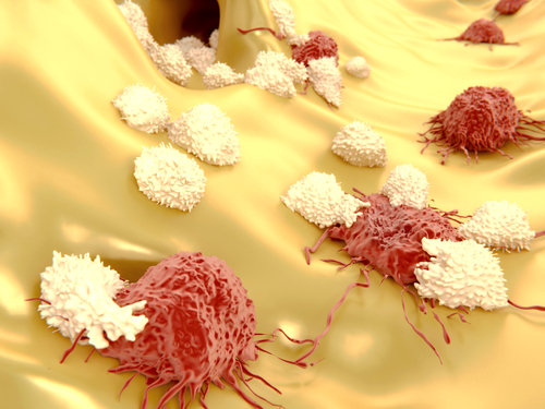 Specialized Immune Cells That Kill Melanoma Cells Identified By Researchers