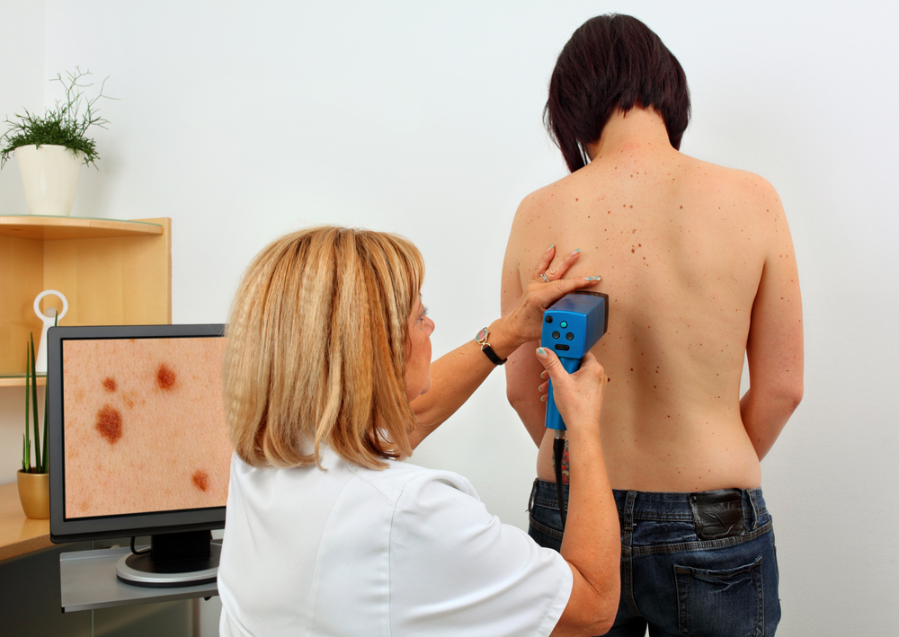 Screening Strategies and Monitoring Patients at Risk of Melanoma Crucial for Early Detection