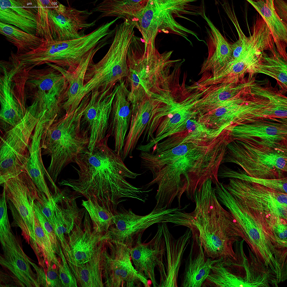 Scientists Can Reprogram Skin Fibroblasts Into Melanocytes