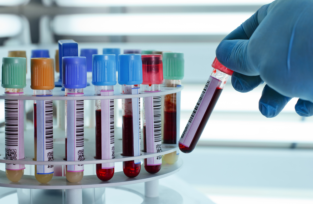 Rockland Immunochemicals Has New Melanoma Cell Lines Available for Research