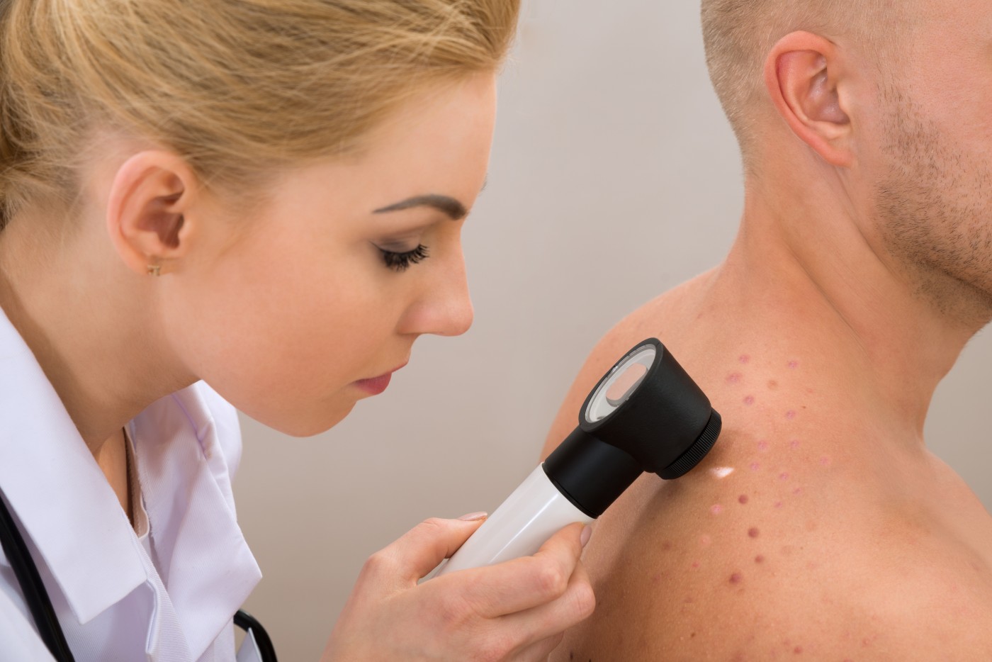 Pensioners in the UK More Likely To Be Diagnosed With Malignant Melanoma
