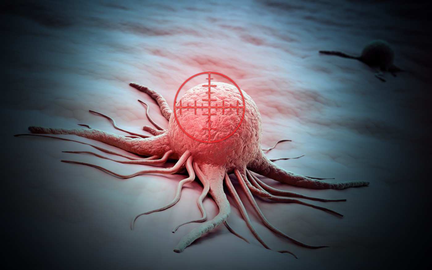 Modified Herpes Virus Increases Survival In Advanced Melanoma Patients