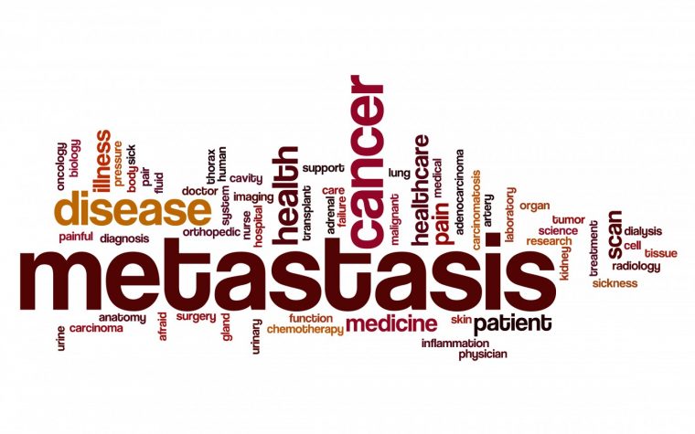 Melanoma metastasis