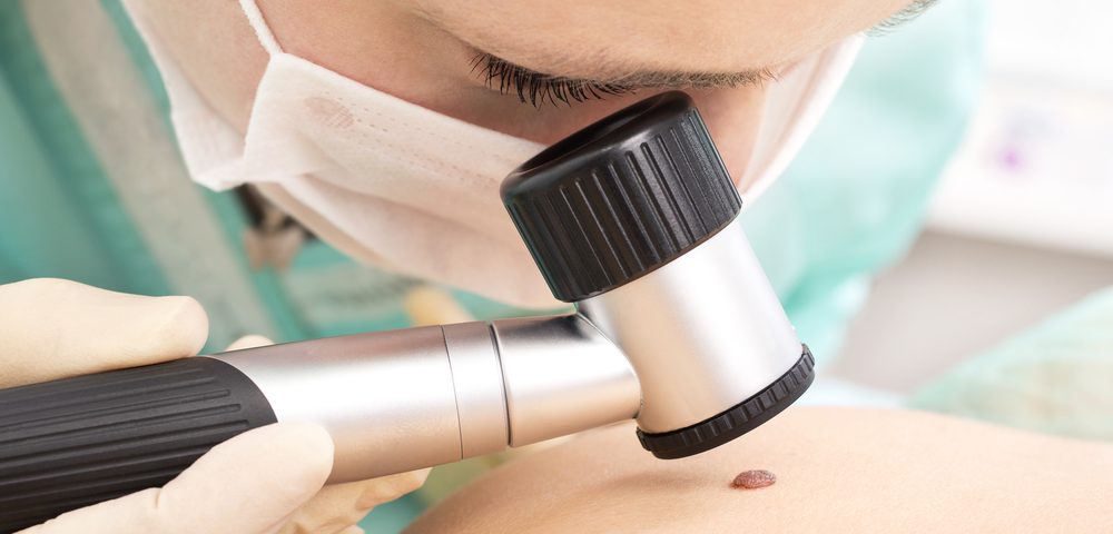 Expert Panel Recommends National Guidelines to Improve Melanoma Screening